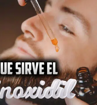 para que sirve el minoxidil