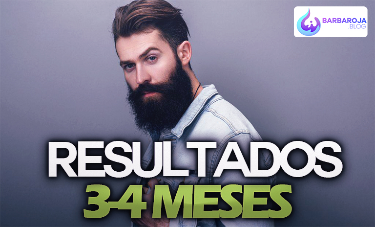 resultados minoxidil kirkland